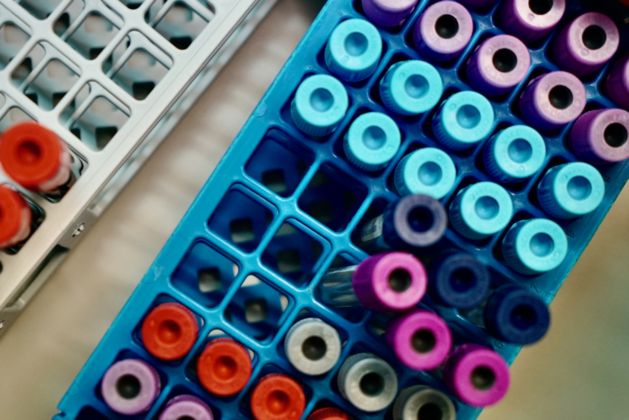 Safata amb tubs d'extracció de sang